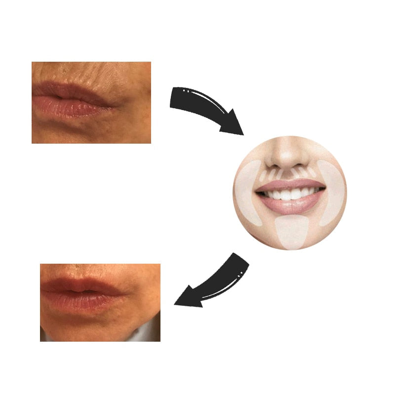 Nuevo botox Libre de Arrugas y Líneas de Expresión 18 Piezas
