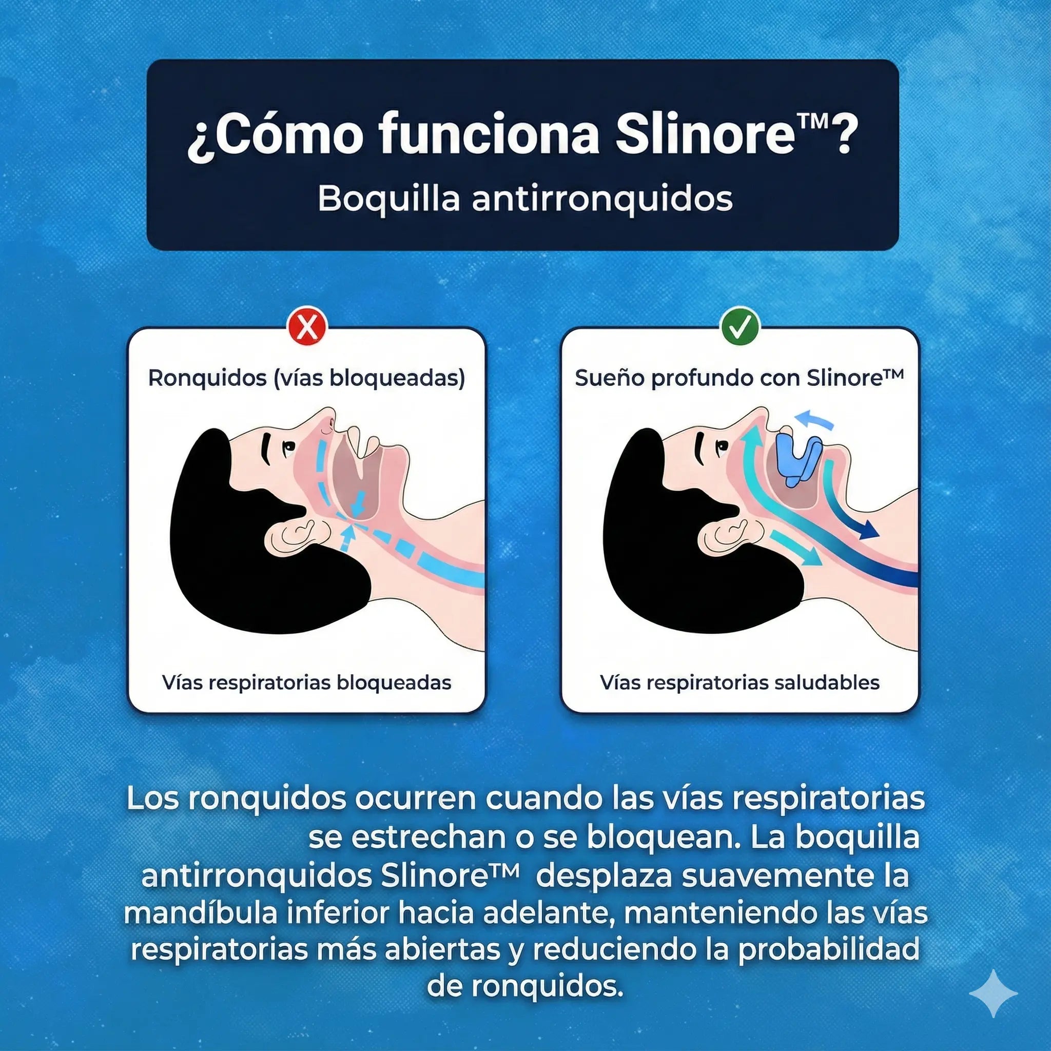 Boquilla Antironquidos Slinore™