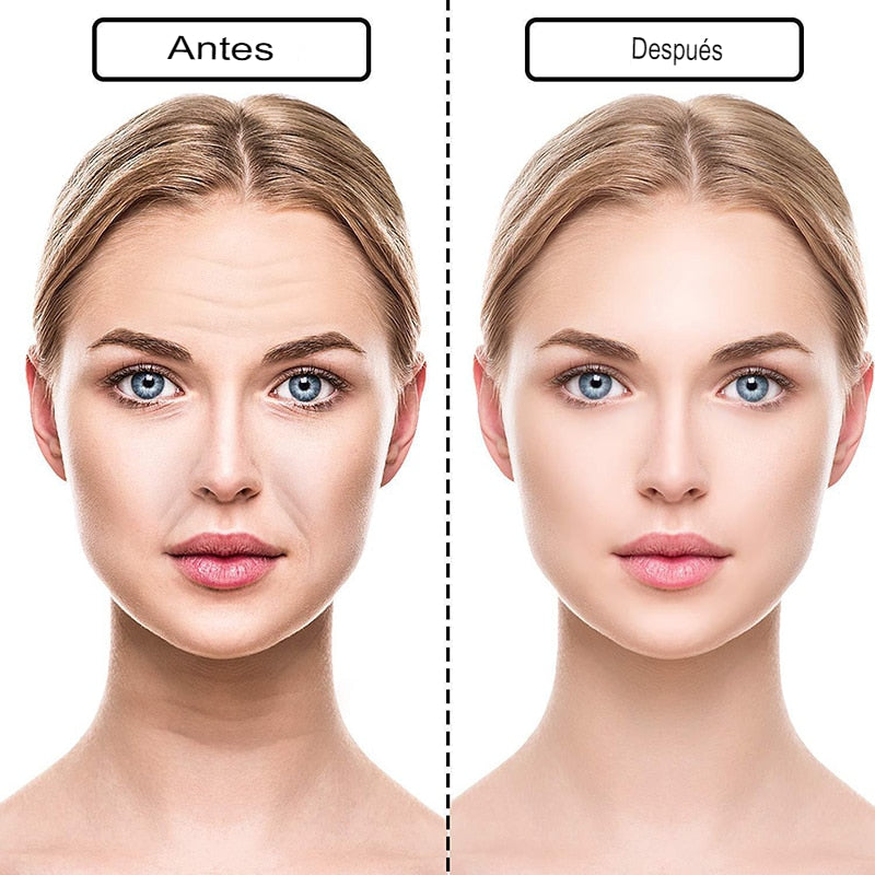 Nuevo botox Libre de Arrugas y Líneas de Expresión 18 Piezas
